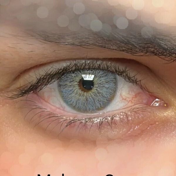 Melrose Gray φακοί επαφής 
